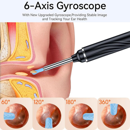 ARVOX Ear Endoscope Otoscope/Wax Cleaner with 1080p FHD Camera with Ultra fine 3.5mm Lens for Kids & Adults with Ear Cleaner Tool Set of 8 for Android & iOS