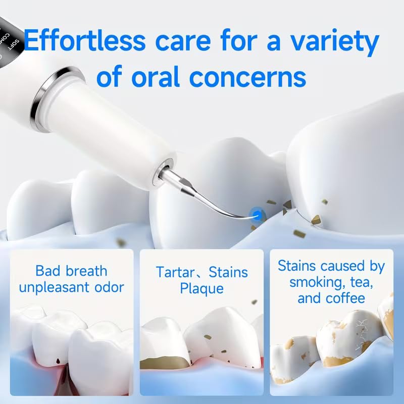 Arvox Electric Teeth Whitening Kit – Instant Teeth Stain Remover, Teeth Tartar Plaque Remover with 5 Adjustable Mode & 3 Replacement Head, Tooth Cleaning Kit with LED for a Brighter Smile